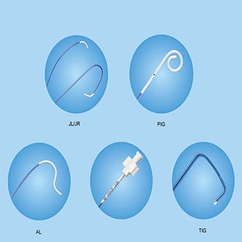 Angiography Catheter